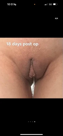 Front View Changes and Future Hopes: An 18-Day Check-In