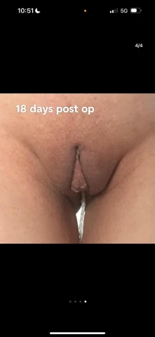 Front View Changes and Future Hopes: An 18-Day Check-In. Image 4 of 4