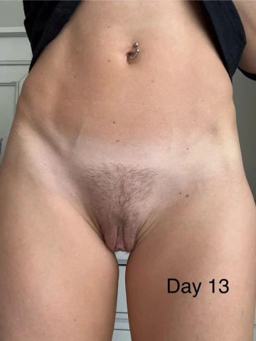 Returning to Work After Labiaplasty: A 14-Day Reality Check. Image 6 of 6