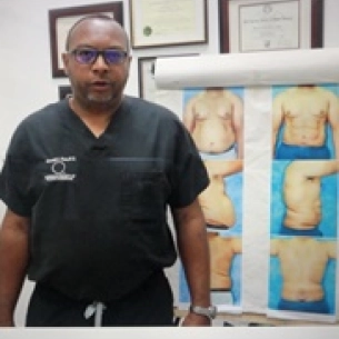Wendell Perry board-certified labiaplasty surgeon