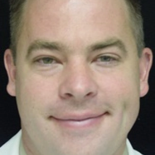 Dale Reynolds board-certified labiaplasty surgeon