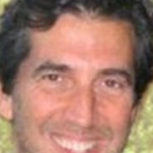Andrew Barnett board-certified labiaplasty surgeon