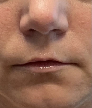 columbus-aesthetic-plastic-surgery-4.jpg