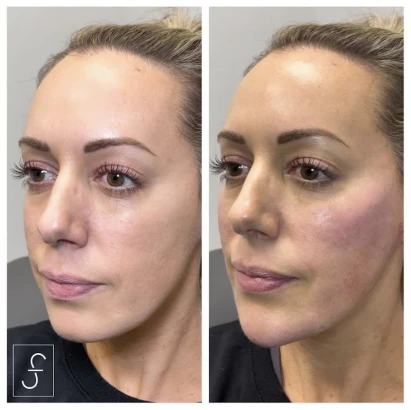 sf-bay-area-plastic-surgery-los-gatos-2.jpg