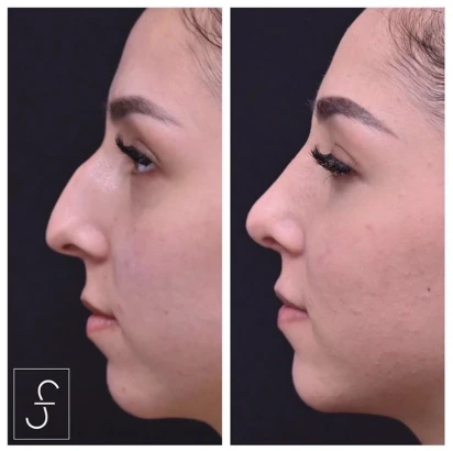 sf-bay-area-plastic-surgery-los-gatos-4.jpg