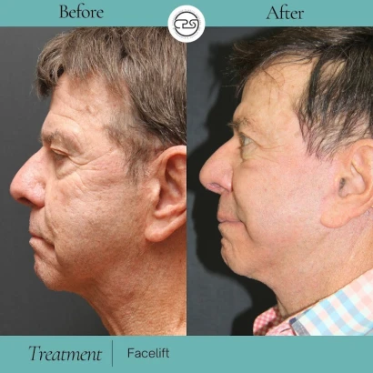 cornerstone-plastic-surgery-aesthetic-medicine-4.jpg