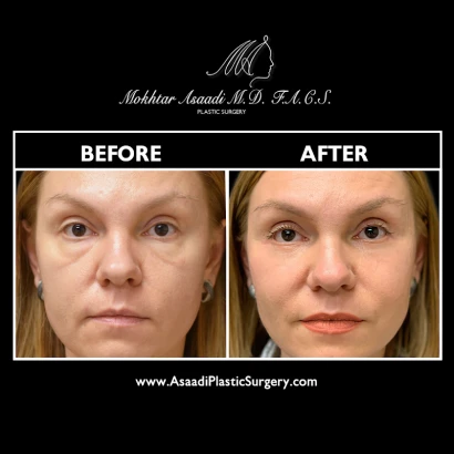 asaadi-plastic-surgery-dr-mokhtar-asaadi-3.png