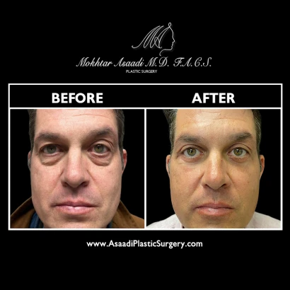 asaadi-plastic-surgery-dr-mokhtar-asaadi-4.png
