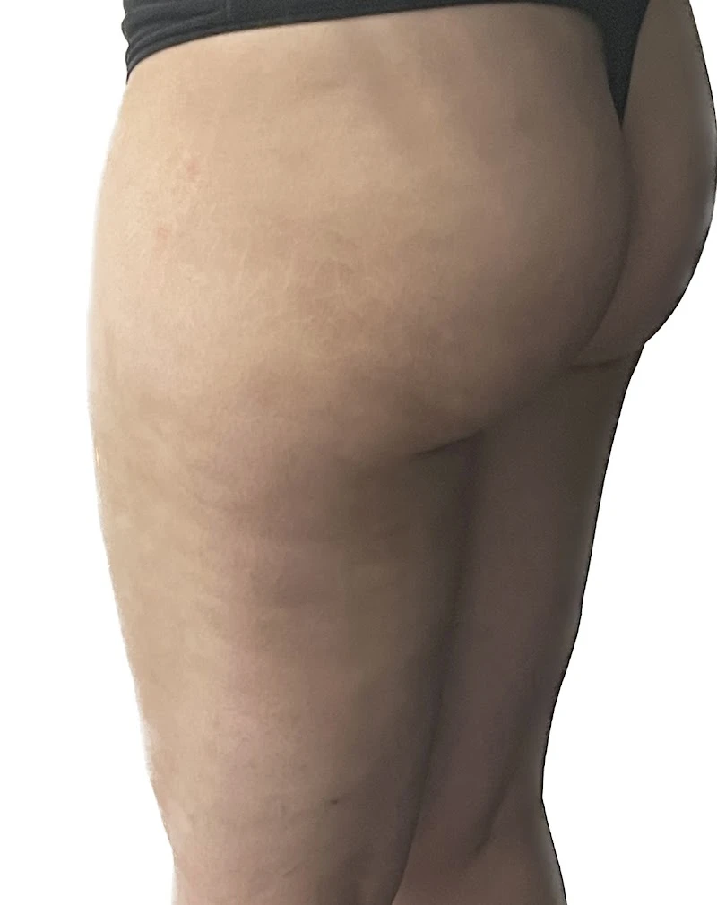Laurie A. Casas MD, FACS, Glenview, Illinois, 60026