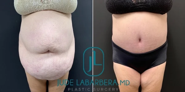 jude-labarbera-md-plastic-surgery-1.jpg