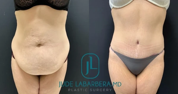 jude-labarbera-md-plastic-surgery-2.jpg
