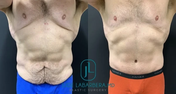 jude-labarbera-md-plastic-surgery-3.jpg