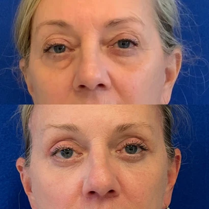 maia-plastic-surgery-munique-maia-md-2.jpg