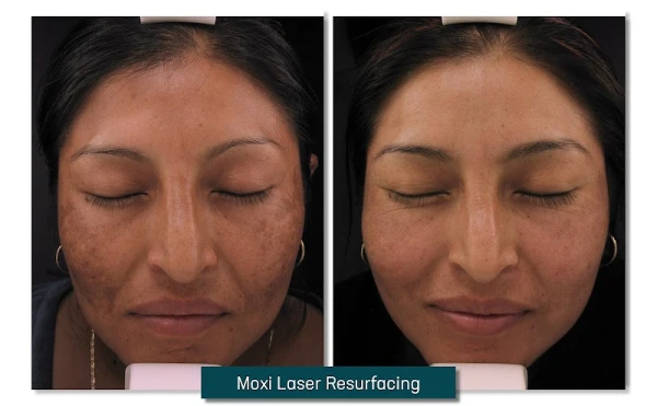profile-md-by-laser-center-of-maryland-2.jpg
