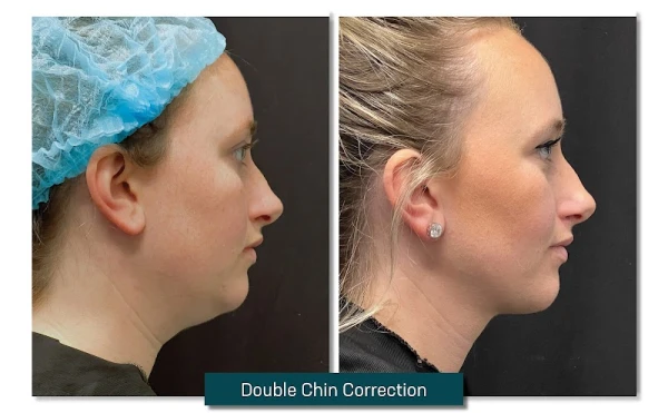 profile-md-by-laser-center-of-maryland-4.jpg