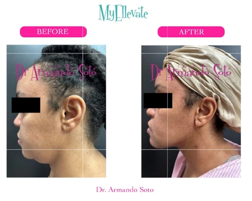 aesthetic-enhancements-plastic-surgery-laser-center-armando-soto-md-3.jpg