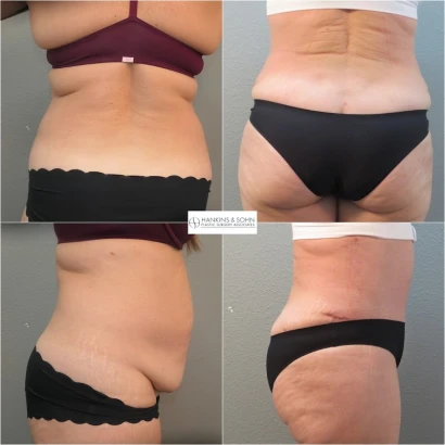 hankins-sohn-plastic-surgery-associates-3.jpg