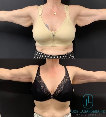 jude-labarbera-md-plastic-surgery-1.jpg
