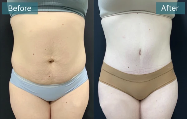 jude-labarbera-md-plastic-surgery-2.png