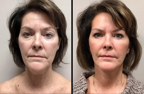 jude-labarbera-md-plastic-surgery-3.jpg