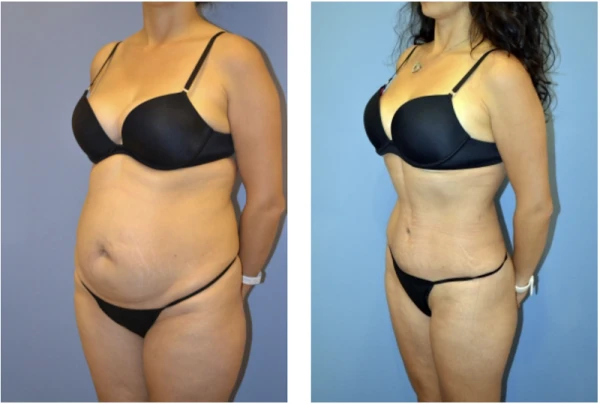 associates-in-plastic-surgery-4.png