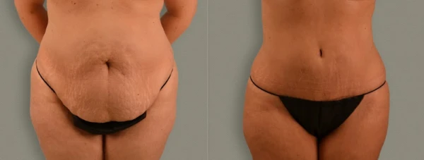 athenix-advanced-plastic-surgery-aesthetic-centers-1.jpg