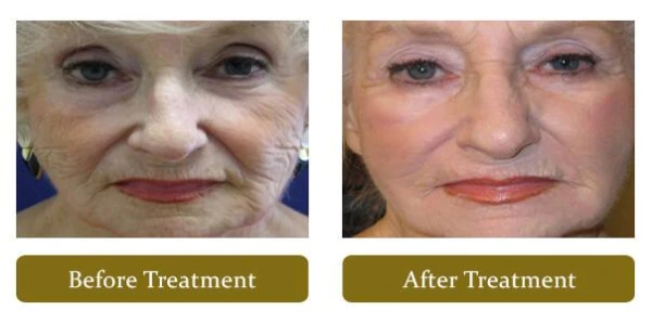 foothill-cosmetic-surgery-center-1.jpg