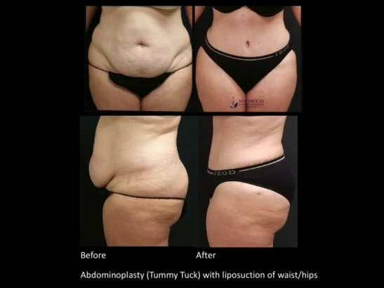 magnolia-plastic-surgery-center-dr-anahita-azharian-do-mph-3.jpg