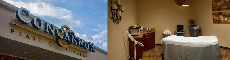 Concannon Plastic Surgery