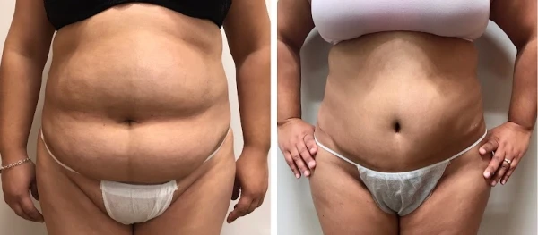 kronowitz-plastic-surgery-houston-1.jpg