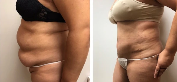 kronowitz-plastic-surgery-houston-2.jpg