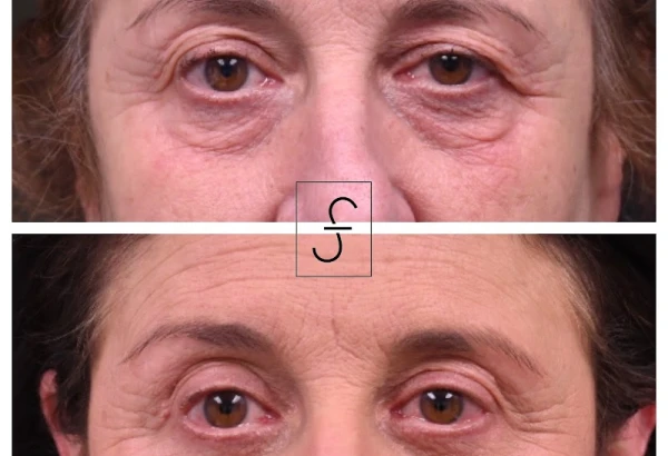 sf-bay-area-plastic-surgery-morgan-hill-4.jpg