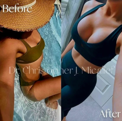 micallef-plastic-surgery-3.jpg