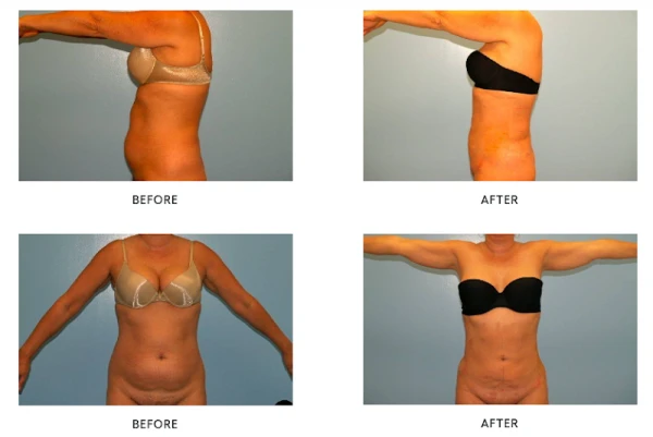 liposuction-and-cosmetic-surgery-institute-2.png