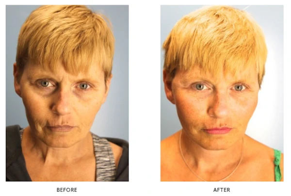 liposuction-and-cosmetic-surgery-institute-3.png