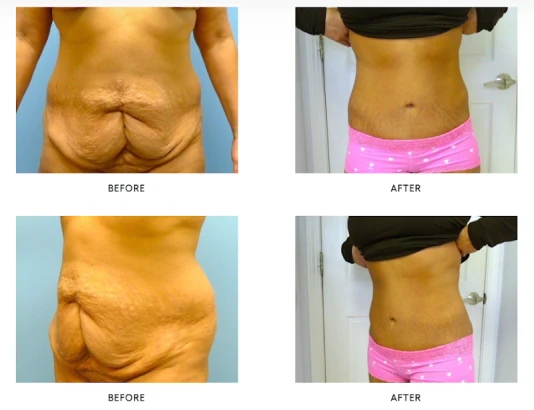 liposuction-and-cosmetic-surgery-institute-4.png