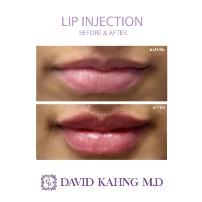 cara-plastic-surgery-laser-center-1.jpg