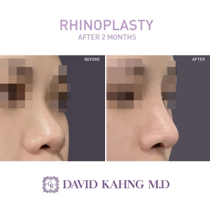 cara-plastic-surgery-laser-center-2.jpg