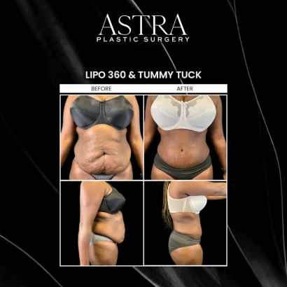 astra-plastic-surgery-alpharetta-4.jpg