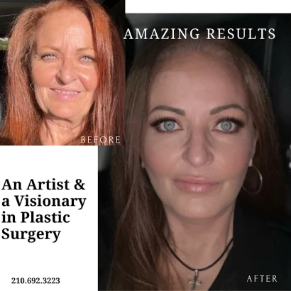 ayala-plastic-surgery-john-ayala-md-4.png