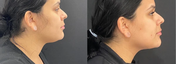 sr-plastic-surgery-p-c-smita-r-ramanadham-m-d-f-a-c-s-4.jpg