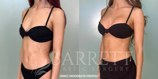 barrett-plastic-surgery-3.png