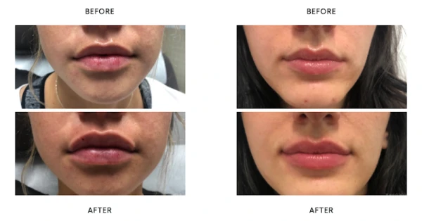 liposuction-and-cosmetic-surgery-institute-3.png