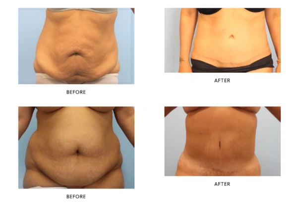liposuction-and-cosmetic-surgery-institute-4.png