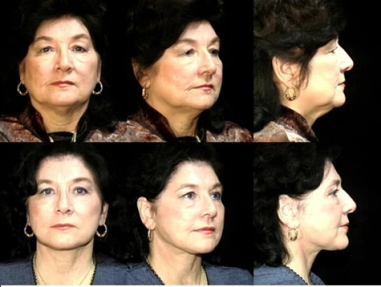 ronald-m-warren-md-facs-4.png