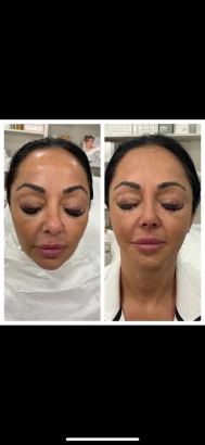 glotoxmd-2.jpg