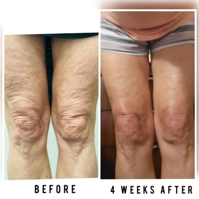 glotoxmd-4.jpg