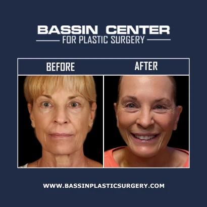 dr-roger-bassin-md-1.jpg