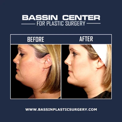 dr-roger-bassin-md-3.jpg