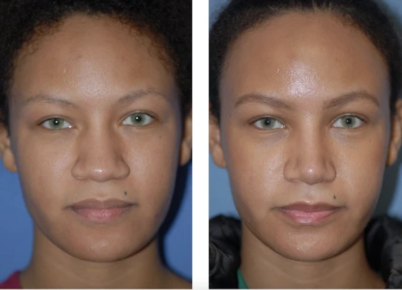 associates-in-plastic-surgery-3.png